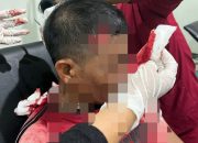Berawal dari Cekcok, Warga di Mapili Duel Parang